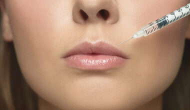 Lip Filler Near Me Why Injector Credentials Matter More Than Price