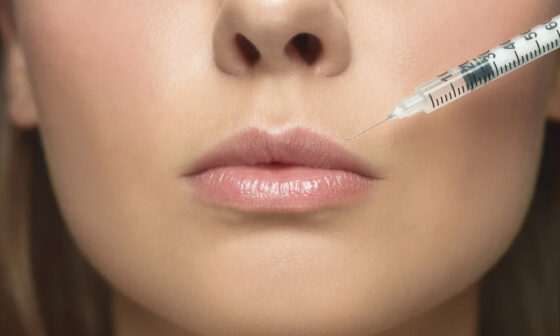 Lip Filler Near Me Why Injector Credentials Matter More Than Price