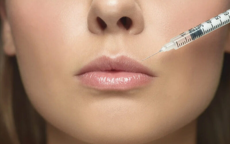 Lip Filler Near Me Why Injector Credentials Matter More Than Price