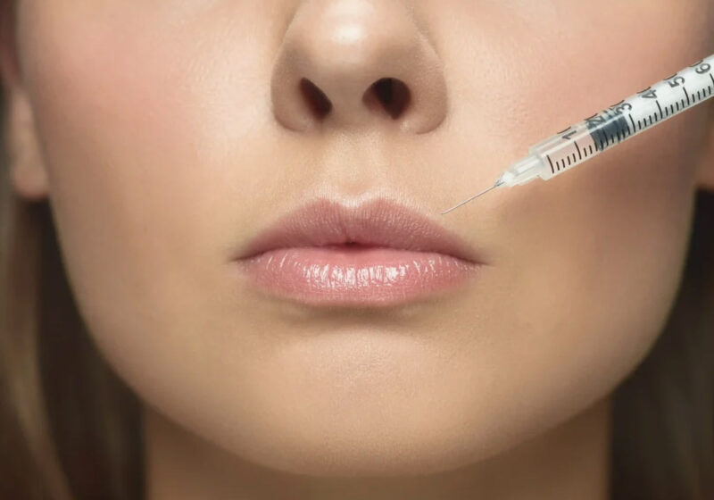 Lip Filler Near Me Why Injector Credentials Matter More Than Price