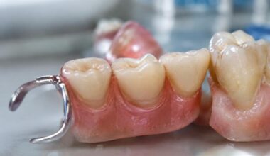 How Catoosa Oklahoma Patients Can Compare Dental Implants Bridges and Dentures