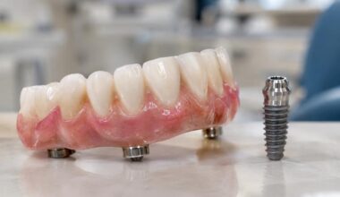 How To Compare Full Arch Tooth Replacement Options in Coventry RI